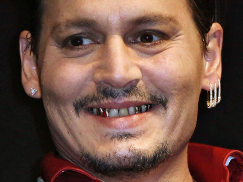 Hollywood Celebrities With Really Bad Teeth