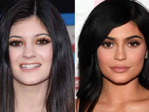 Check Out This List of Celebrities Whose Looks Changed For The Good (Or Worse!) After Plastic Surgery