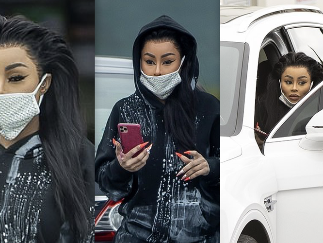 15 Botched Beauty Surgeries That Make You Question People’s Sanity