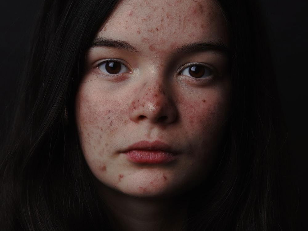 9 Of The Most Dangerous Social Media Skin-Care Myths That You Should Avoid