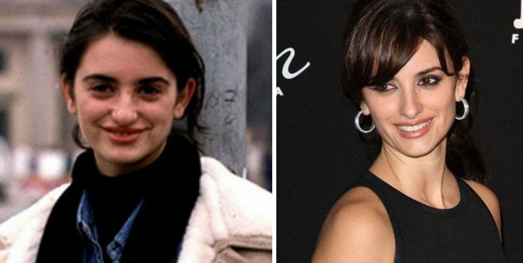 Penelope Cruz Before Plastic Surgery, Forehead, Hair, Nose, Head, Lip, Chin, Smile, Hairstyle, Eyebrow, Eye
