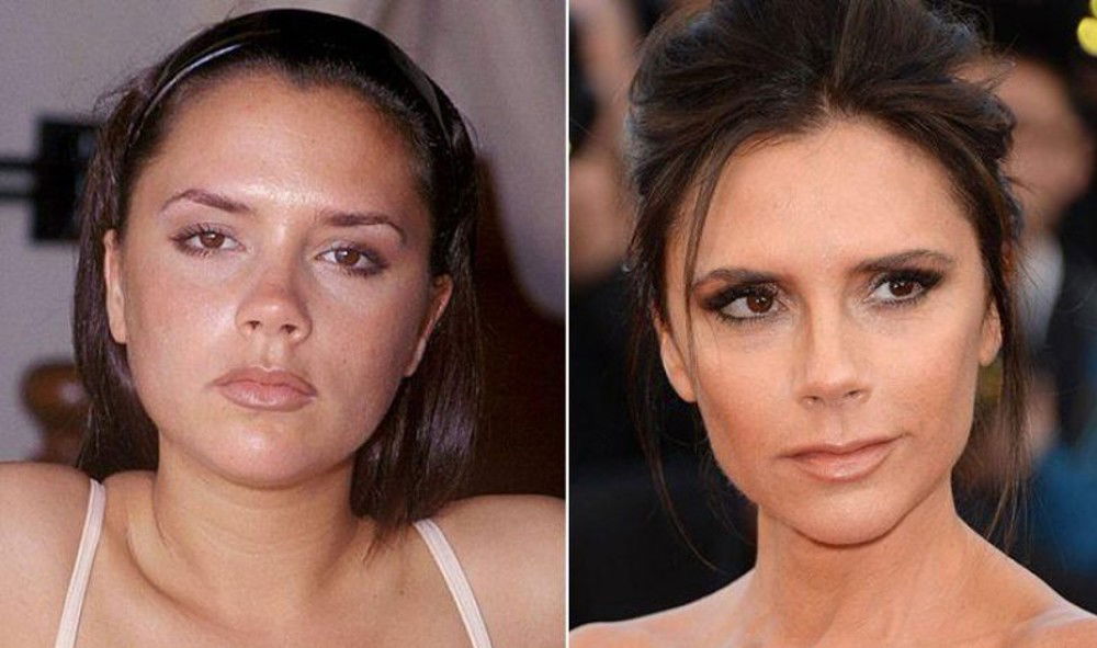 Victoria Beckham Before, Forehead, Nose, Cheek, Skin, Lip, Chin, Eyebrow, Eye, Facial expression, Eyelash