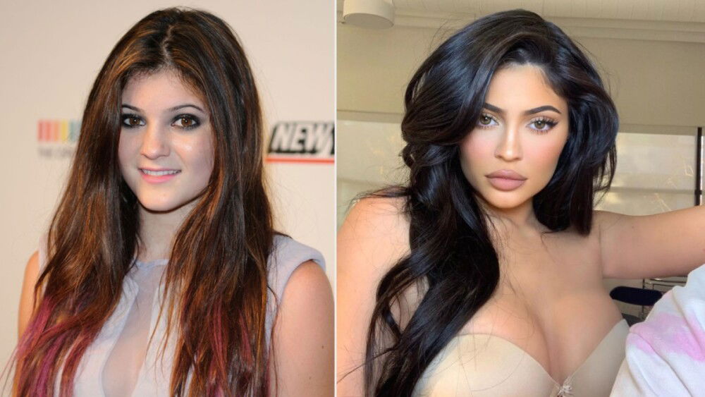 Kylie Jenner Hot Hair, Hair, Skin, Lip, Chin, Eyebrow, Shoulder, Eye, Eyelash, Neck, Makeover