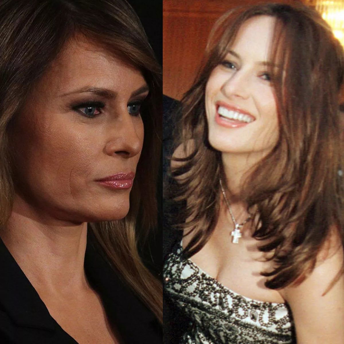 Melania Trump: Throwback Photos vs. Now, Amidst Facelift Speculation