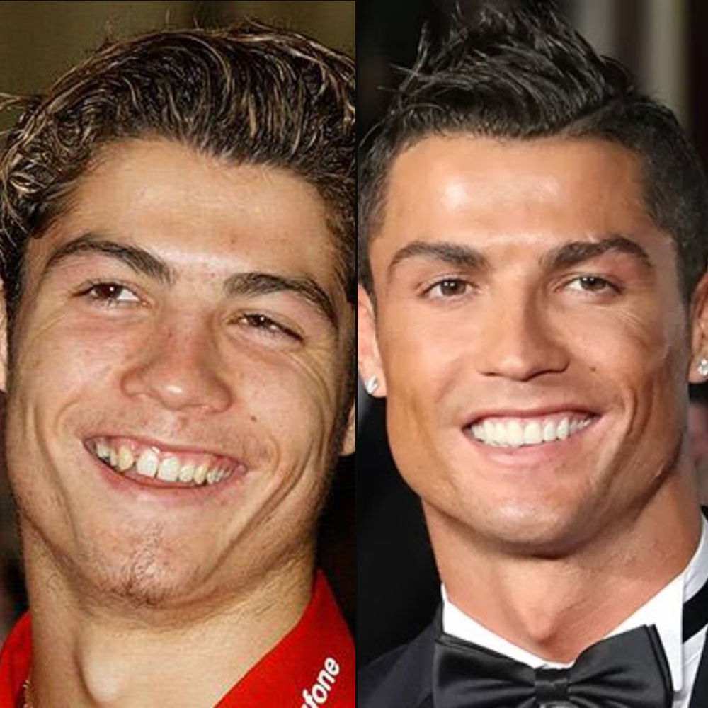 Cristiano Ronaldo’s Changing Face—Did He Get Cosmetic Surgery?